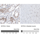 Anti-SETD2 Antibody