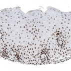 Immunohistochemical staining of human cervix, uterine shows moderate to strong nuclear positivity in squamous epithelial cells.