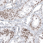 Immunohistochemical staining of human testis shows strong nuclear positivity in cells in seminiferous ducts.