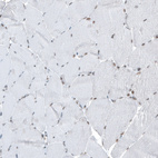 Immunohistochemical staining of human skeletal muscle shows very weak positivity in myocytes as expected.