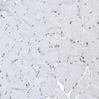 Immunohistochemical staining of human skeletal muscle shows very weak positivity in myocytes as expected.