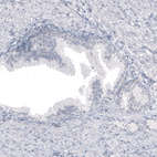 Anti-SPAG5 Antibody