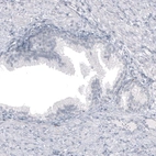 Immunohistochemical staining of human prostate shows no cytoplasmic positivity in glandular cells as expected.