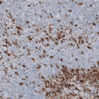 Immunohistochemical staining of human tonsil shows strong cytoplasmic positivity in non-germinal center cells.
