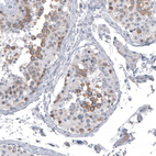 Anti-SPAG5 Antibody