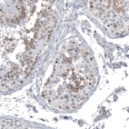 Immunohistochemical staining of human testis shows moderate cytoplasmic positivity in cells in seminiferous ducts.