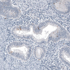 Anti-SPAG5 Antibody