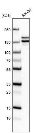 Western blot analysis in human cell line RH-30.