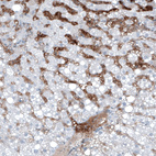 Anti-AFP Antibody