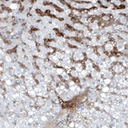 Anti-AFP Antibody