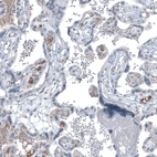 Immunohistochemical staining of human placenta shows moderate positivity in secretion.