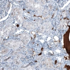 Immunohistochemical staining of human kidney shows moderate positivity in secretion.