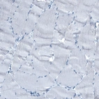Immunohistochemical staining of human skeletal muscle shows no positivity as expected.