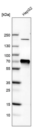 Western blot analysis in human cell line HepG2.