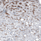 Anti-AFP Antibody