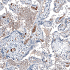 Immunohistochemical staining of human placenta shows moderate positivity in secretion.