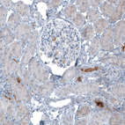 Anti-AFP Antibody