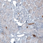 Immunohistochemical staining of human kidney shows moderate positivity in secretion.