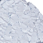 Immunohistochemical staining of human skeletal muscle shows no positivity as expected.