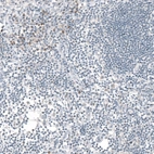 Immunohistochemical staining of human lymph node shows moderate cytoplasmic positivity in a subset of lymphoid cells.