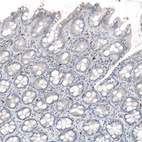 Immunohistochemical staining of human rectum shows moderate cytoplasmic positivity in lymphoid cells.