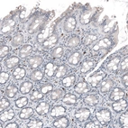 Immunohistochemical staining of human rectum shows moderate cytoplasmic positivity in lymphoid cells.