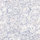 Anti-IL17A Antibody