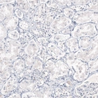 Immunohistochemical staining of human kidney shows no positivity in cells in tubules as expected.