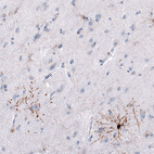 Anti-GPR17 Antibody