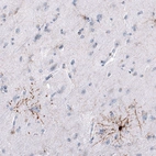 Immunohistochemical staining of human cerebral cortex shows moderate cytoplasmic positivity in a subset of oligodendrocytes.