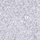 Anti-GPR17 Antibody