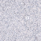 Immunohistochemical staining of human pancreas shows no positivity in exocrine glandular cells as expected.