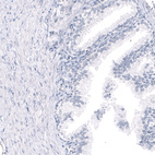 Anti-GPR17 Antibody