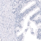 Immunohistochemical staining of human prostate shows no positivity in glandular cells as expected.