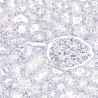 Immunohistochemical staining of human kidney shows no positivity in cells in tubules as expected.