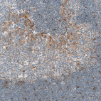Immunohistochemical staining of human tonsil shows moderate positivity in secretion in germinal center.