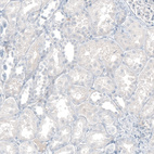 Anti-CXCL13 Antibody