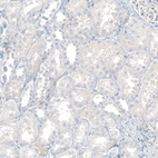 Immunohistochemical staining of human kidney shows no positivity in cells in tubules as expected.