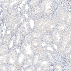 Immunohistochemical staining of human kidney shows no positivity in cells in tubules as expected.