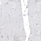 Immunohistochemical staining of human skeletal muscle shows no positivity in myocytes as expected.