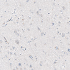 Immunohistochemical staining of human cerebral cortex shows no positivity in neurons as expected.