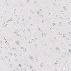 Immunohistochemical staining of human cerebral cortex shows no positivity in neurons as expected.