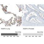 Anti-AGER Antibody