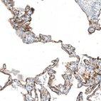 Immunohistochemical staining of human lung shows strong membranous positivity in pneumocytes.