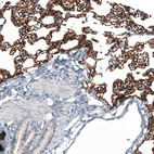 Immunohistochemical staining of rat lung shows strong membranous positivity in pneumocytes.