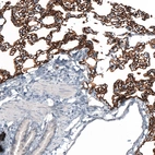 Immunohistochemical staining of rat lung shows strong membranous positivity in pneumocytes.