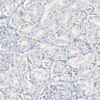 Anti-AGER Antibody