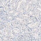 Immunohistochemical staining of human kidney shows no positivity in cells in tubules as expected.