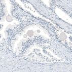 Anti-AGER Antibody