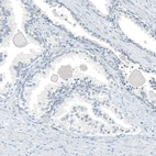 Immunohistochemical staining of human prostate shows no positivity in glandular cells as expected.